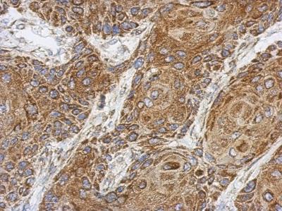 Immunohistochemistry-Paraffin: C1orf111 Antibody [NBP2-15640] - Analysis of paraffin-embedded Cal27 xenograft, using antibody at 1:500 dilution.