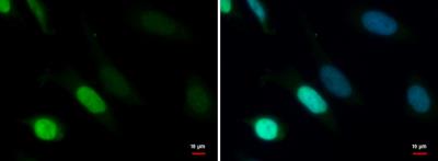 Immunocytochemistry/Immunofluorescence: TDG Antibody [NBP2-20627] - HeLa cells were fixed in 4% paraformaldehyde at RT for 15 min.Green: TDG protein stained by TDG antibody  diluted at 1:1000. Blue: Hoechst 33342 staining.