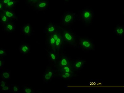 Immunocytochemistry/Immunofluorescence: TAF11 Antibody (3G6) [H00006882-M06] - Analysis of monoclonal antibody to TAF11 on HeLa cell. Antibody concentration 10 ug/ml