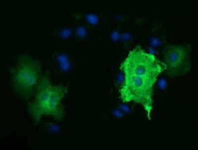 Immunocytochemistry/Immunofluorescence: Tubulin alpha-3E Antibody (2A8) [NBP2-02878] Staining of COS7 cells transiently transfected by pCMV6-ENTRY Tubulin alpha-3E.