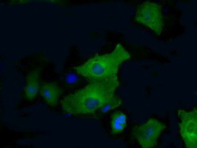 Immunocytochemistry/Immunofluorescence: PFKFB4 Antibody (1C8) [NBP2-02226] Staining of COS7 cells transiently transfected by pCMV6-ENTRY PFKFB4.