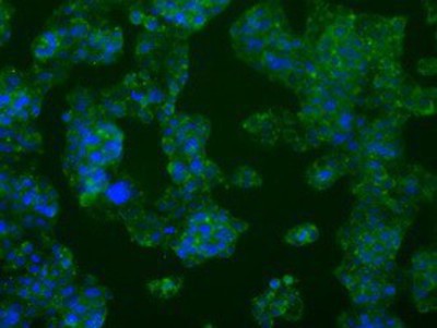 Immunocytochemistry/Immunofluorescence: PFKFB4 Antibody (1C8) [NBP2-02226] - Staining of HepG2 cells using anti-PFKFB4 mouse monoclonal antibody.