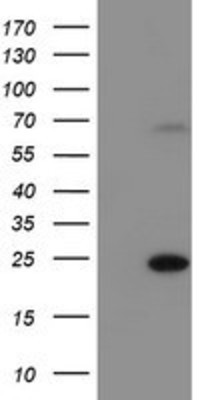 Western Blot: C6orf64 Antibody (2H3) [NBP2-02000] - HEK293T cells were transfected with the pCMV6-ENTRY control (Left lane) or pCMV6-ENTRY C6orf64 (Right lane) cDNA for 48 hrs and lysed. Equivalent amounts of cell lysates (5 ug per lane) were separated by SDS-PAGE and immunoblotted with anti-C6orf64.