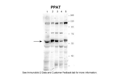 Western Blot: Phosphoribosyl Pyrophosphate Amidotransferase Antibody [NBP1-52964] - 1. Human Skin Fibroblasts (100ug) 2. HepG2 cells (20 ug) 3. HEK273 cells (20 ug) 4. HeLa skin cells(20 ug) 5. Hamster CHO K1 cells (20 ug) Primary Dilution: 1 : 5000 Secondary Antibody: Clean-Blot IP detection Reagent and Kit Secondary Dilution: 1 : 2000.