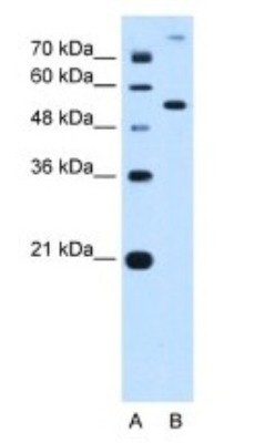 Western Blot: Phosphoribosyl Pyrophosphate Amidotransferase Antibody [NBP1-52964] - HepG2 Cell Lysate, concentration 0.25ug/ml.