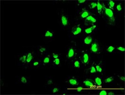Immunocytochemistry/Immunofluorescence: POLR1C Antibody (3A5-H2) [H00009533-M01] - Analysis of monoclonal antibody to POLR1C on HeLa cell. Antibody concentration 7 ug/ml.