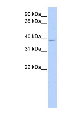 Western Blot: C18orf25 Antibody [NBP1-57595] - 721_B cell lysate, concentration 0.2-1 ug/ml.