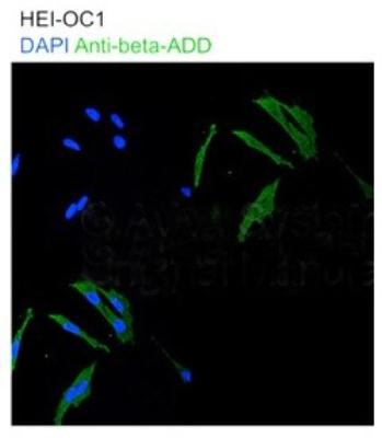 Immunocytochemistry/Immunofluorescence: beta Adducin Antibody [NBP1-53079] - HEI-OC1 DAP1 Anti-beta-ADD