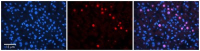 Immunocytochemistry/Immunofluorescence: RAD54B Antibody [NBP1-58233] - Antibody   Formalin Fixed Paraffin Embedded Tissue: Human Adult Liver  Observed Staining: Nuclear in hepatocytes, very strong signal, wide tissue distribution