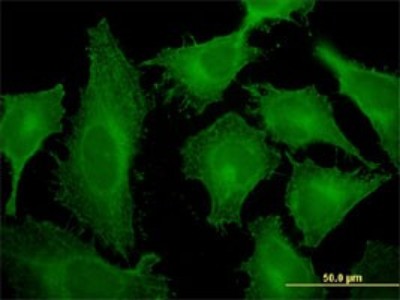 Immunocytochemistry/Immunofluorescence: Tropomodulin 3 Antibody (1E1) [H00029766-M10] - Analysis of monoclonal antibody to TMOD3 on HeLa cell. Antibody concentration 10 ug/ml