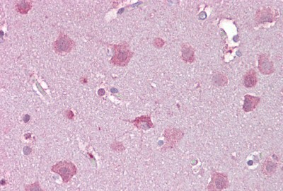 Immunohistochemistry-Paraffin: NDP/Norrin Antibody [NBP1-59305] - Human Brain, cortex tissue at an antibody concentration of 5ug/ml.