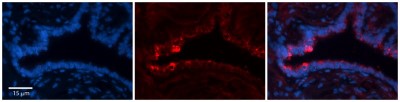 Immunocytochemistry/Immunofluorescence: NETO2 Antibody [NBP1-62591] - Formalin Fixed Paraffin Embedded Tissue: Human Bronchial Epithelial Tissue  Observed Staining: Cytoplasmic