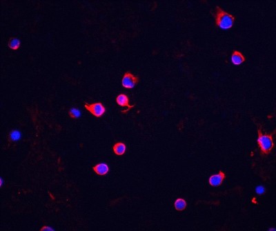 Immunocytochemistry/Immunofluorescence: Chk2 Antibody [NBP1-76780] - Staining of Chk2 in Jurkat cells with Chk2 antibody at 5 ug/mL