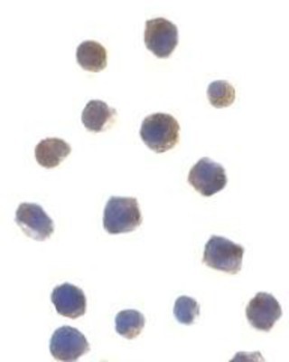 Immunocytochemistry/Immunofluorescence: Chk2 Antibody [NBP1-76780] - Jurkat cells with Chk2 antibody at 1 ug/ml.
