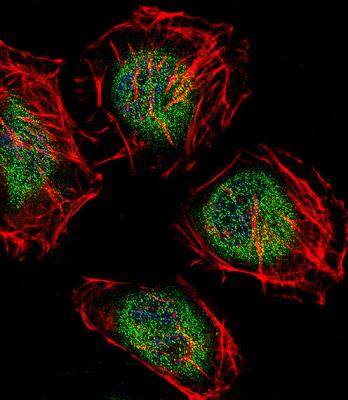 Immunocytochemistry/Immunofluorescence: CNOT7 Antibody [NBP2-29987] - Fluorescent confocal image of Hela cell stained with CAF-1 Antibody (N-term)(NBP2-29987).Hela cells were fixed with 4% PFA (20 min), permeabilized with Triton X-100 (0.1%, 10 min), then incubated with CAF-1 primary antibody (1:25, 1 h at 37). For secondary antibody, Alexa Fluor 488 conjugated donkey anti-rabbit antibody (green) was used (1:400, 50 min at 37).Cytoplasmic actin was counterstained with Alexa Fluor 555 (red) conjugated Phalloidin (7units/ml, 1 h at 37). Nuclei were counterstained with DAPI (blue) (10 ug/ml, 10 min). CAF-1 immunoreactivity is localized to Cytoplasm and Nucleus significantly.