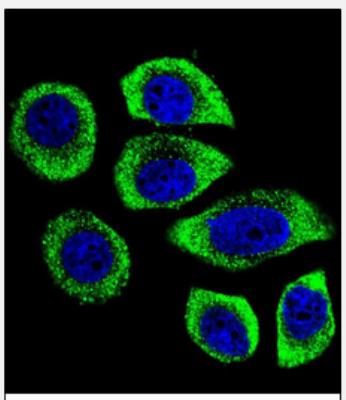 Immunocytochemistry/Immunofluorescence: PIP5KL1 Antibody [NBP2-29992] - Confocal immunofluorescent analysis of  (N-term)(NBP2-29992) with U-251MG cell followed by Alexa Fluor 488-conjugated goat anti-rabbit lgG (green). DAPI was used to stain the cell nuclear (blue).