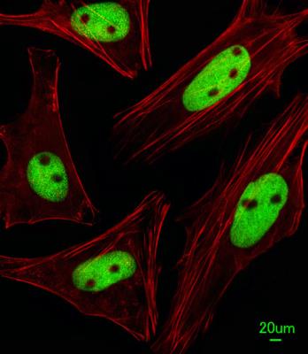 Immunocytochemistry/Immunofluorescence: KRBA2 Antibody [NBP2-29996] - Immunofluorescent analysis of Hela cells, using  (Center) (NBP2-29996). NBP2-29996 was diluted at 1:25 dilution. Alexa Fluor 488-conjugated goat anti-rabbit lgG at 1:400 dilution was used as the secondary antibody (green). Cytoplasmic actin was counterstained with Dylight Fluor 554 (red) conjugated Phalloidin (red).