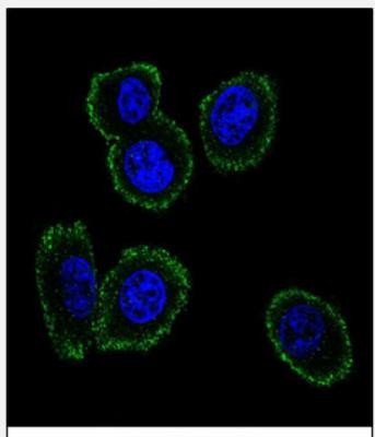 Immunocytochemistry/Immunofluorescence: Neuromedin B Antibody [NBP2-30061] - Confocal immunofluorescent analysis of NMB Antibody (Center) (NBP2-30061) with MDA-MB231 cell followed by Alexa Fluor 488-conjugated goat anti-rabbit lgG (green). DAPI was used to stain the cell nuclear (blue).