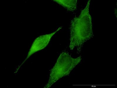 Immunocytochemistry/Immunofluorescence: Septin-8 Antibody (3G1) [H00023176-M08] - Analysis of monoclonal antibody to SEPT8 on HeLa cell. Antibody concentration 30 ug/ml