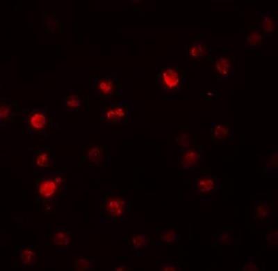 Immunofluorescence: PDP1/PPAPDC2 Antibody [NBP1-76245] - in Raji cells.