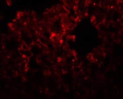 Immunofluorescence: RHBDD3 Antibody [NBP1-76250] - Immunofluorescence of RHBDD32 in rat lung tissue with RHBDD3 antibody at 20 ug/mL.
