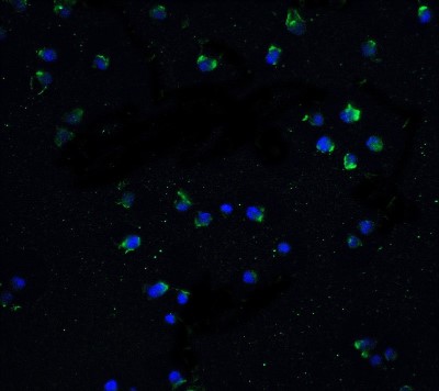 Immunocytochemistry/Immunofluorescence: DR3/TNFRSF25 Antibody [NBP1-76478] - Staining of DR3 in Jurkat cells with DR3 antibody at 5 ug/ml.