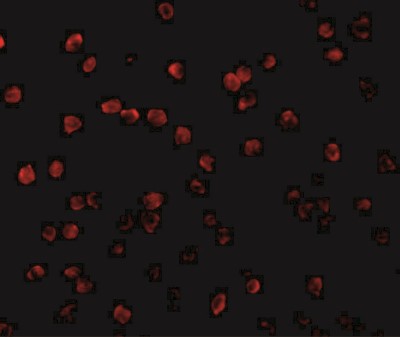 Immunocytochemistry/Immunofluorescence: RSK1 Antibody [NBP1-76620] - Immunofluorescence of RP S6 Kinase in Jurkat cells with RP S6 Kinase antibody at 20 ug/mL.