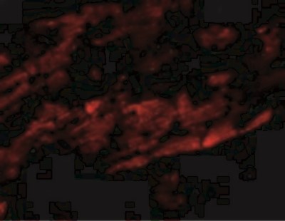 Immunocytochemistry/Immunofluorescence: ZFYVE26 Antibody [NBP1-76331] - Immunofluorescence of SPG15 in Mouse Heart tissue with SPG15 antibody at 20 ug/mL.
