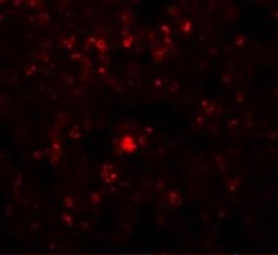 Immunofluorescence: RHBDD2 Antibody [NBP1-76249] - Immunofluorescence of RHBDD2 in Rat Lung cells with RHBDD2 antibody at 20 ug/mL.