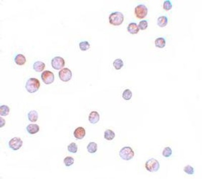 Immunocytochemistry/Immunofluorescence: FOXO4 Antibody [NBP1-77174] - HeLa cells with FOXO4 antibody at 10 ug/mL.