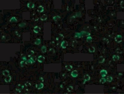 Immunocytochemistry/Immunofluorescence: IKK beta Antibody [NBP1-76935] - Immunofluorescence of IKK beta in Hela cells with IKK beta antibody at 10 ug/mL.