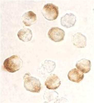 Immunocytochemistry/Immunofluorescence: IKK beta Antibody [NBP1-76935] - Immunocytochemical analysis of IKK b in formalin-fixed HeLa cells using NBP1-76935 at 10 ug/ml.