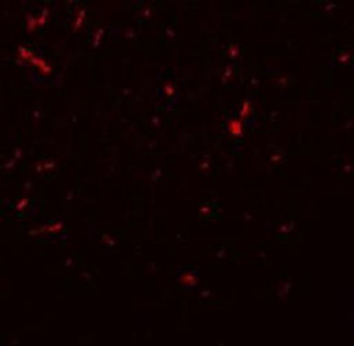 Immunocytochemistry/Immunofluorescence: Sirtuin 1/SIRT1 Antibody [NBP1-77167] - Rat lung tissue with SIRT1 antibody at 20 ug/mL.