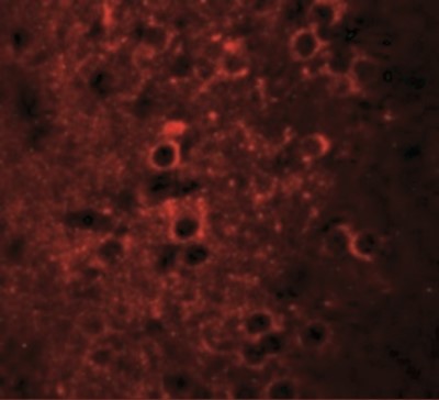Immunocytochemistry/Immunofluorescence: NSRP1 Antibody [NBP2-41139] - Immunofluorescence of CCDC55 in mouse brain cells with CCDC55 antibody at 20 ug/mL.