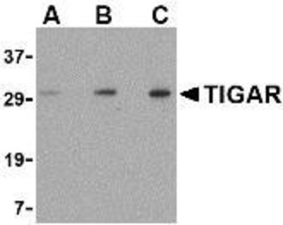 Western Blot: TIGAR/C12orf5 Antibody [NBP1-76765] - EL4 cell lysate with TIGAR antibody at (A) 0.5, (B) 1 and (C) 2 ug/ml.