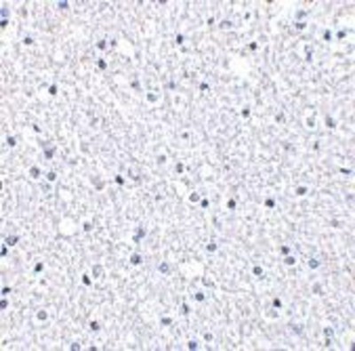 Immunohistochemistry-Paraffin: TIGAR/C12orf5 Antibody [NBP1-76765] - Human brain tissue with TIGAR antibody at 2.5 ug/ml.