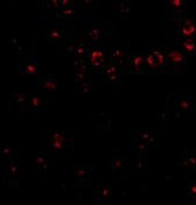 Immunocytochemistry/Immunofluorescence: Integrin alpha 4/CD49d Antibody [NBP1-76945] - Jurkat cells with Integrin alpha 4 antibody at 2 ug/ml.