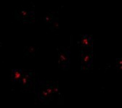 Immunocytochemistry/Immunofluorescence: Lass5 Antibody [NBP1-77328] - Immunofluorescence of LASS5 in human brain tissue with LASS5 antibody at 20 ug/ml.