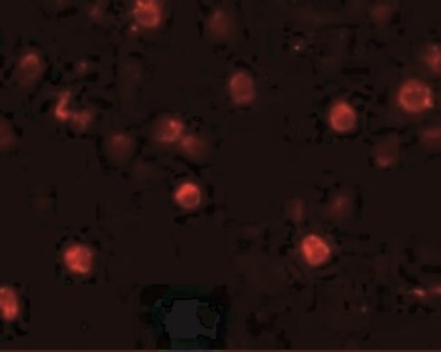 Immunocytochemistry/Immunofluorescence: 2B4/CD244/SLAMF4 Antibody [NBP1-76558] - Immunofluorescence of SLAMF4 in Daudi cells with SLAMF4 antibody at 20 ug/mL.