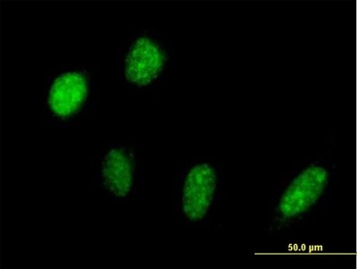 Immunocytochemistry/Immunofluorescence: PRP18 Antibody [H00008559-B02P] - Analysis of purified antibody to PRPF18 on HeLa cell. (antibody concentration 10 ug/ml)