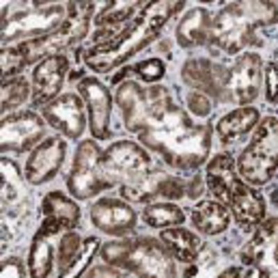 Immunohistochemistry: AKAP1 Antibody [27850002] - Most normal tissues and malignant tissues showed strong cytoplasmic immunoreactivity. Decidual cells in placenta were moderately stained. Bile ducts, renal glomeruli and stromal cells along with some of the malignant lymphomas and renal cancers were weakly stained or negative.  Image and statement courtesy of the Human Protein Atlas (HPA).