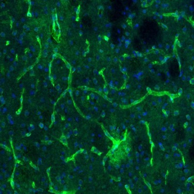 Immunocytochemistry/Immunofluorescence: USP11 Antibody [NBP1-80639] - Staining of mouse caudate putamen shows positivity in blood vessels.