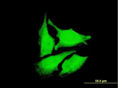 Immunocytochemistry/Immunofluorescence: DEPDC1A Antibody (6H1) [H00055635-M05] - Analysis of monoclonal antibody to DEPDC1 on HeLa cell. Antibody concentration 10 ug/ml
