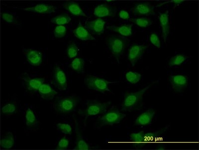 Immunocytochemistry/Immunofluorescence: MED21 Antibody (2D9) [H00009412-M10] - Analysis of monoclonal antibody to SURB7 on HeLa cell. Antibody concentration 10 ug/ml