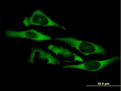 Immunocytochemistry/Immunofluorescence: QARS Antibody [H00005859-B01P] - Analysis of purified antibody to QARS on HeLa cell. (antibody concentration 10 ug/ml)