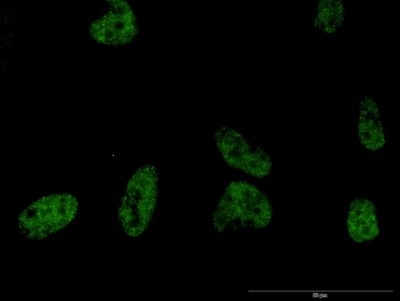 Immunocytochemistry/Immunofluorescence: Phospholipase C beta 2 Antibody (1B3) [H00005330-M03] - Analysis of monoclonal antibody to PLCB2 on HeLa cell. Antibody concentration 40 ug/ml