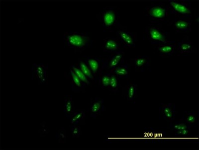 Immunocytochemistry/Immunofluorescence: NVL Antibody [H00004931-B01P] - Analysis of purified antibody to NVL on HeLa cell. (antibody concentration 10 ug/ml)
