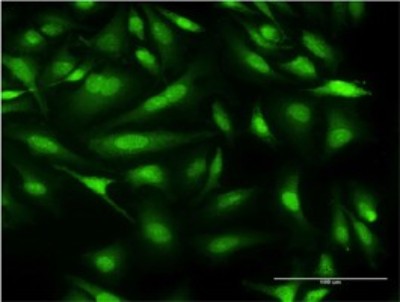 Immunocytochemistry/Immunofluorescence: CALML3 Antibody (2A11) [H00000810-M04] - Analysis of monoclonal antibody to CALML3 on HeLa cell. Antibody concentration 10 ug/ml