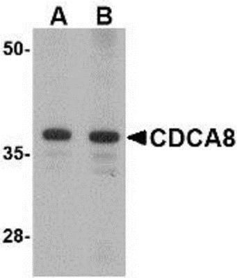 Western Blot: Borealin Antibody [NBP1-77330] - Rat kidney lysate with Borealin antibody at (A) 1 and (B) 2 ug/ml.