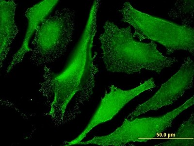 Immunocytochemistry/Immunofluorescence: POTEH Antibody (3G10) [H00023784-M07] - Analysis of monoclonal antibody to POTEH on HeLa cell. Antibody concentration 10 ug/ml